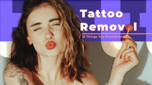 Tattoo Removal Before and After