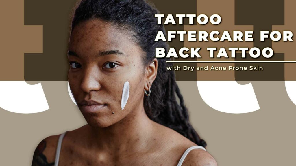 Tattoos and Acne What You Need to Know Before Getting Inked