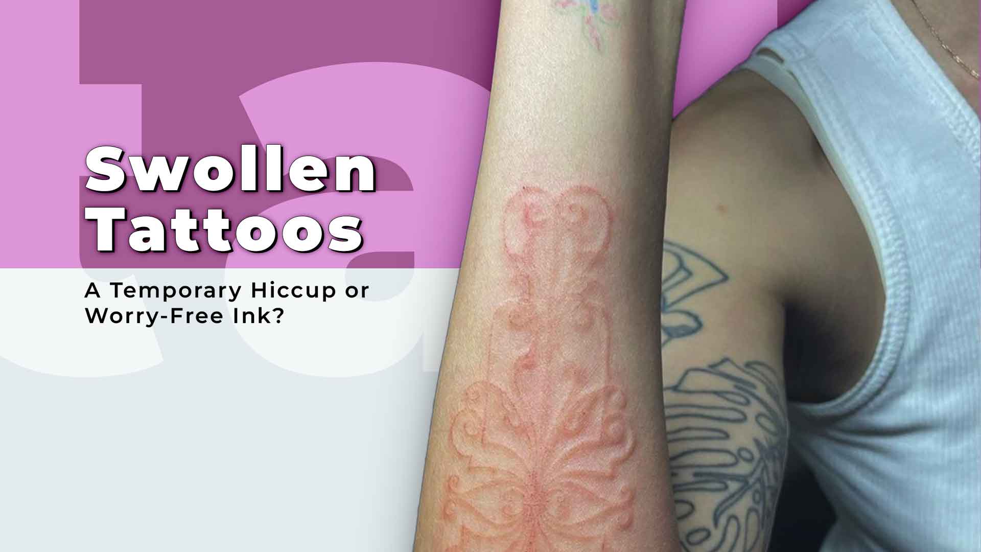 Dealing with Swollen Tattoos: Causes, Treatment, and Aftercare
