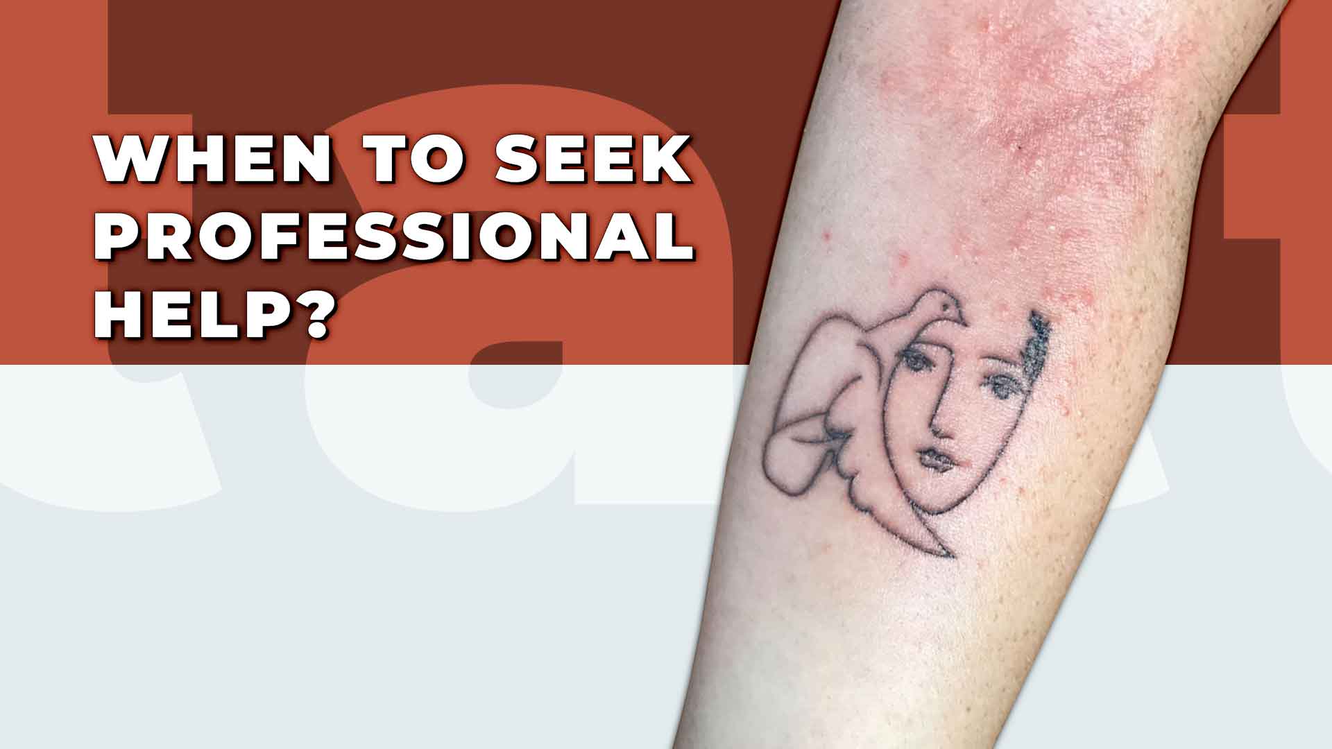 Tattoos and Eczema: Are They a Bad Idea?