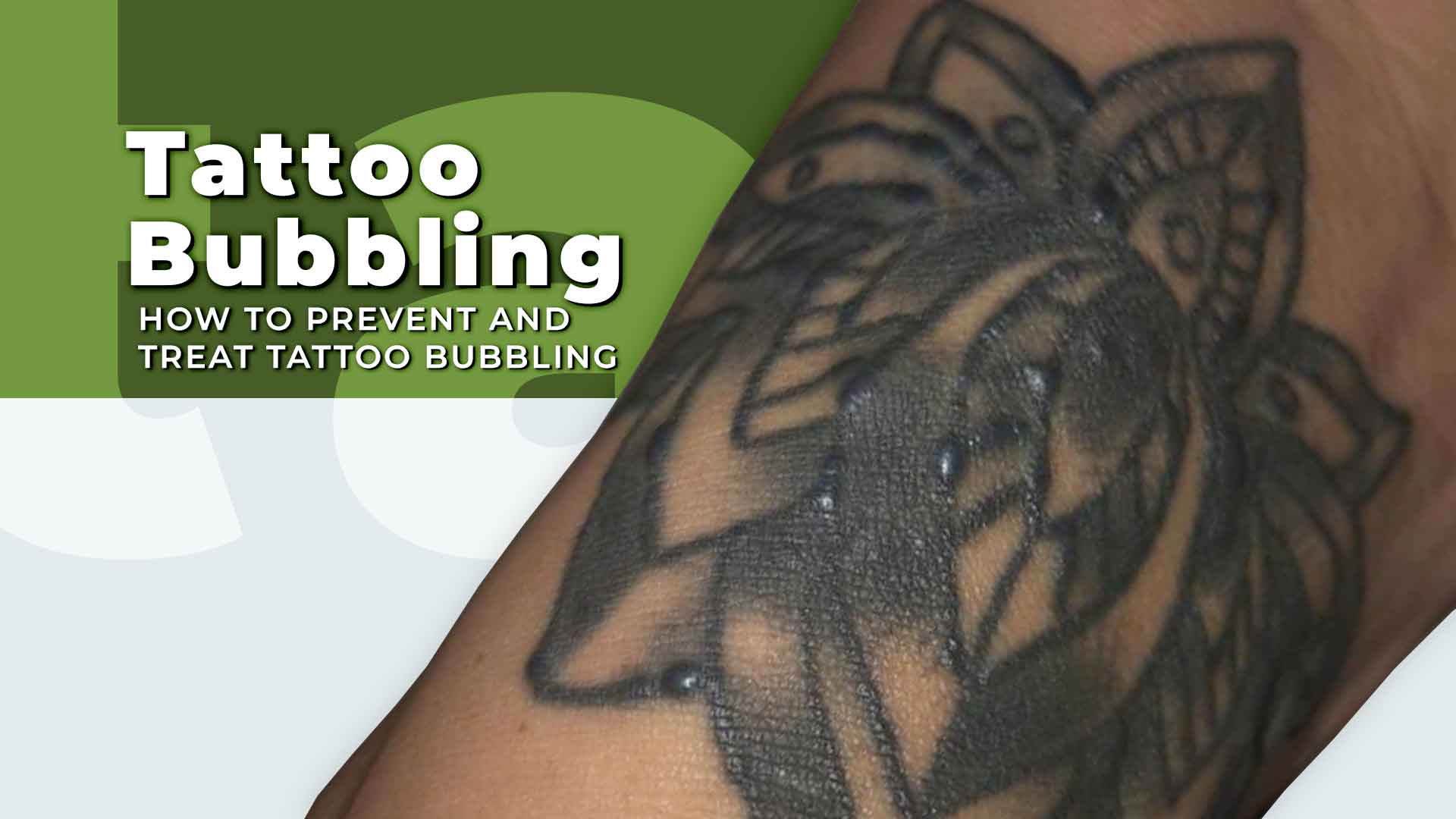Tattoo Bubbling